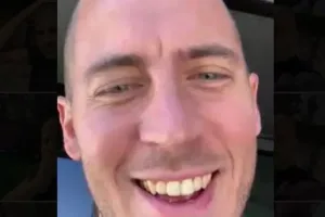 Profile 19 bald hazard 1