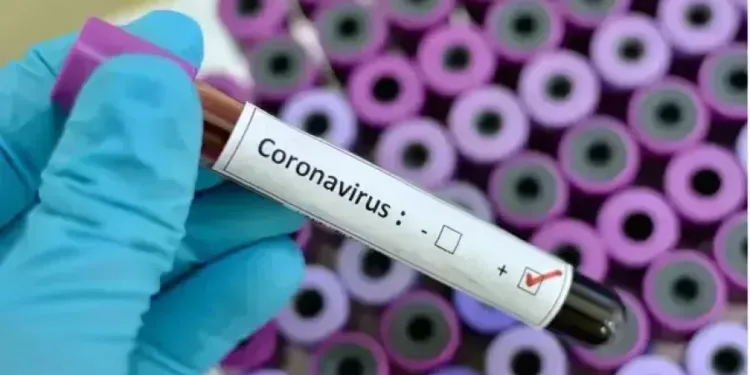 Coronavirus 3 1, Newsblenda