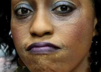 Here are 2 ways to know that you bought a bleaching cream