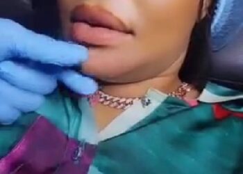 Nollywood Actress, Angela Okorie flaunts newly acquired chin (VIDEO)