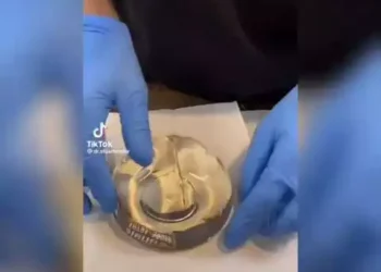 See what most ladies use for butt enlargement