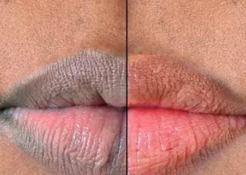 Beauty Tips: Here are 5 simple ways to get pink lips