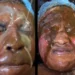 Viral video of a man and woman bleaching their skin in a very shocking procedure