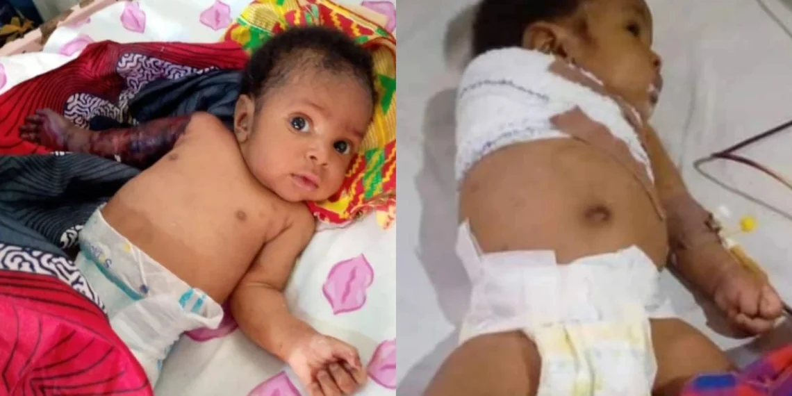 Father cuts his 2-month-old baby's hands with hanger for disturbing his sleep 1 Father cuts his 2-month-old baby’s hands with hanger for disturbing his sleep