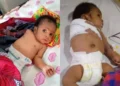 Father cuts his 2-month-old baby’s hands with hanger for disturbing his sleep
