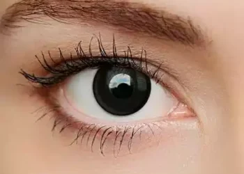 5 ways to naturally get white eyes