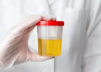 5 colours of urine and what they say about your health