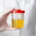 5 colours of urine and what they say about your health 10 5 colours of urine and what they say about your health
