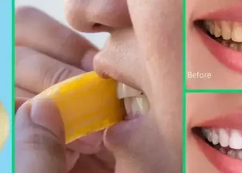 Here’s how to whiten your teeth using banana peels