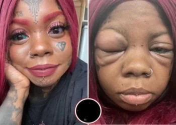 Mother goes blind after tattooing her eyeballs against her daughter’s advice