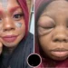Mother goes blind after tattooing her eyeballs against her daughter's advice 10 Mother goes blind after tattooing her eyeballs against her daughter’s advice