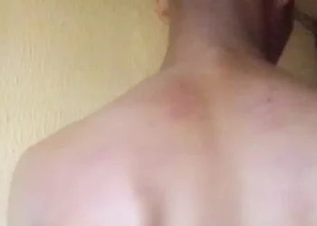 Mother protests as Lagos principal brutalizes 14-year-old student