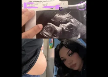 Lady Wakes Up To Discover She’s 9 Months Pregnant Without Any Symptoms