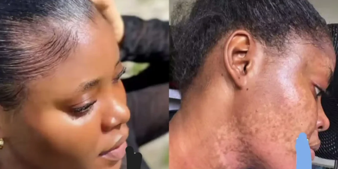 Organic beauty care gone wrong: Lady shares before and after using organic beauty products (Video) 1 Organic beauty care gone wrong: Lady shares before and after using organic beauty products (Video)