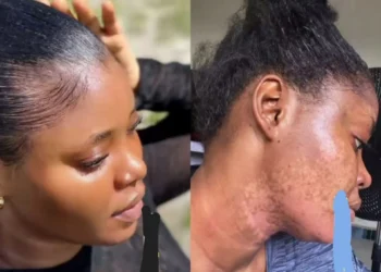 Organic beauty care gone wrong: Lady shares before and after using organic beauty products (Video)