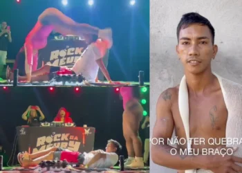 Man disfigures his elbow while watching a dancer’s buttocks (Watch Video)