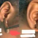 Snake-like Worms Of Different Sizes Pulled Out Of A Lady's Ear (Watch Video) 11 Snake-like Worms Of Different Sizes Pulled Out Of A Lady’s Ear (Watch Video)