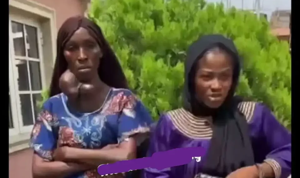 Osun Lady rejects free goiter surgery, prefers 300k cash (Video) 1 Osun Lady rejects free goiter surgery, prefers 300k cash (Video)