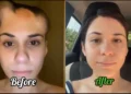 Before and After Video of a brain tumor cancer survivor