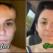 Before and After Video of a brain tumor cancer survivor 10 Before and After Video of a brain tumor cancer survivor