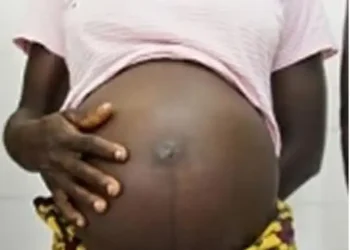 Fiancee exposes man who impregnates both mother and daughter same time
