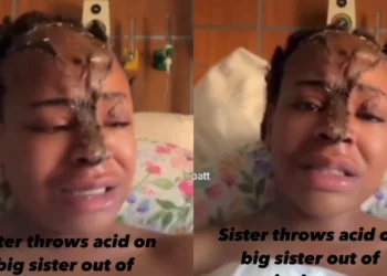Lady shed tears after her sister disfigured her face with acid out of jealousy [VIDEO]