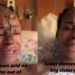 Lady shed tears after her sister disfigured her face with acid out of jealousy [VIDEO]