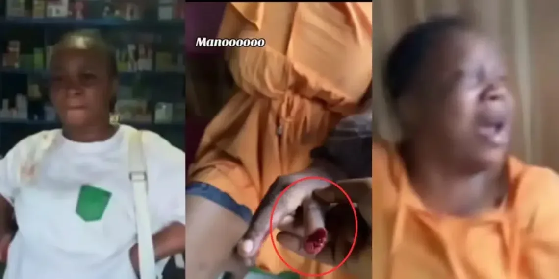 Drama as Wife Bites Off Finger of Husband's Side Chick 1 Drama as Wife Bites Off Finger of Husband’s Side Chick