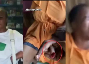 Drama as Wife Bites Off Finger of Husband’s Side Chick