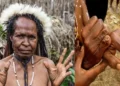 The Painful Tradition: Why Papua New Guinea Families Cut Off Their Fingers in Mourning